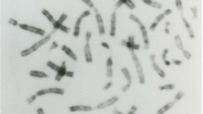 Human chromosomes. Image from flickr.com (Author: WÅdanaz)