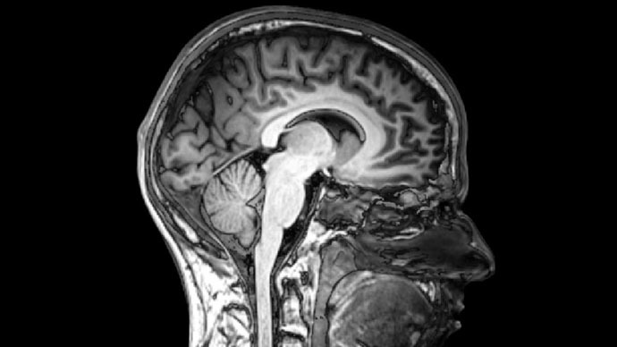 Serotonin brain map could revolutionize antidepressants