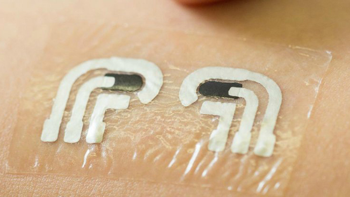 Temporary tattoo can tell diabetics their glucose levels