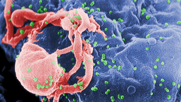 ​Aggressive HIV strain leading to AIDS in 3 years discovered in Cuba