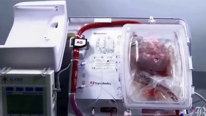 Europe’s first ‘dead' heart transplanted in UK — RT UK News