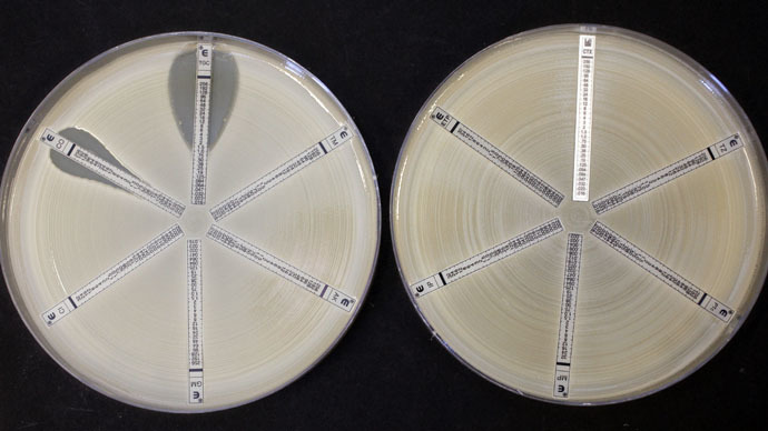 British govt warns superbug epidemic could wipe out 80,000