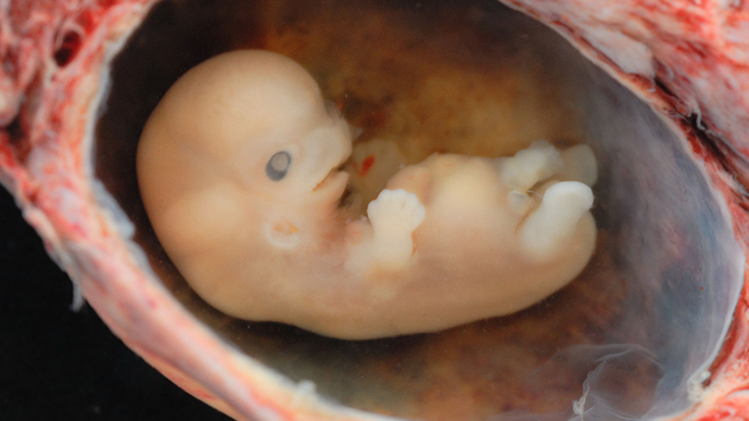 ‘Ethically risky’: Switzerland votes to screen embryos for genetic defects