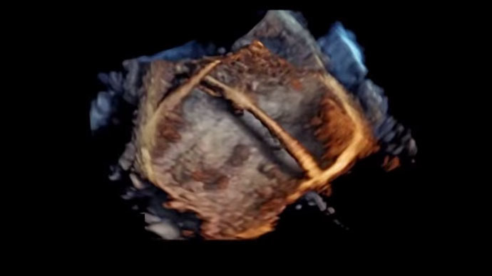 Revolutionary 4D images of human heart (PHOTOS, VIDEOS)
