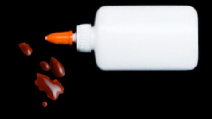 Report: Iraqi militants use instant glue to torture gays