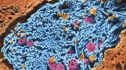 Israel to pay $6 million compensation to anthrax vaccine trial subjects