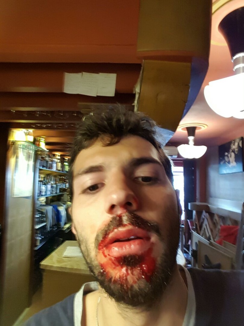 Marseille : fortes tensions entre les supporters et la police, nombreux blessés (PHOTOS, VIDEOS)