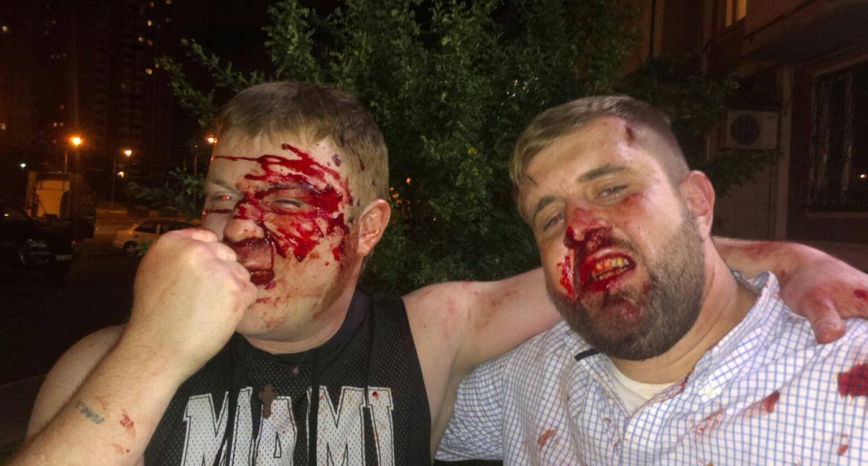 Ivre, un hooligan russe donne un coup de poing au visage d'un journaliste en direct (VIDEO)