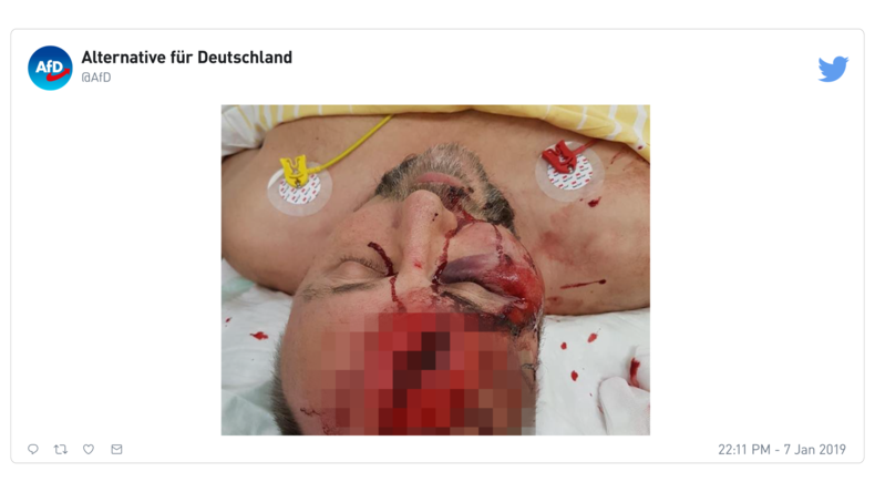 Allemagne : le chef de l'AfD à Brême grièvement blessé lors d'une agression (PHOTO CHOC)
