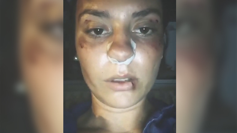 Une jeune femme témoigne de sa violente agression alors qu'elle promenait son chien à Nîmes