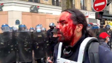 Du «maquillage» pour ce manifestant en sang ? BFMTV rétropédale après une «information erronée»