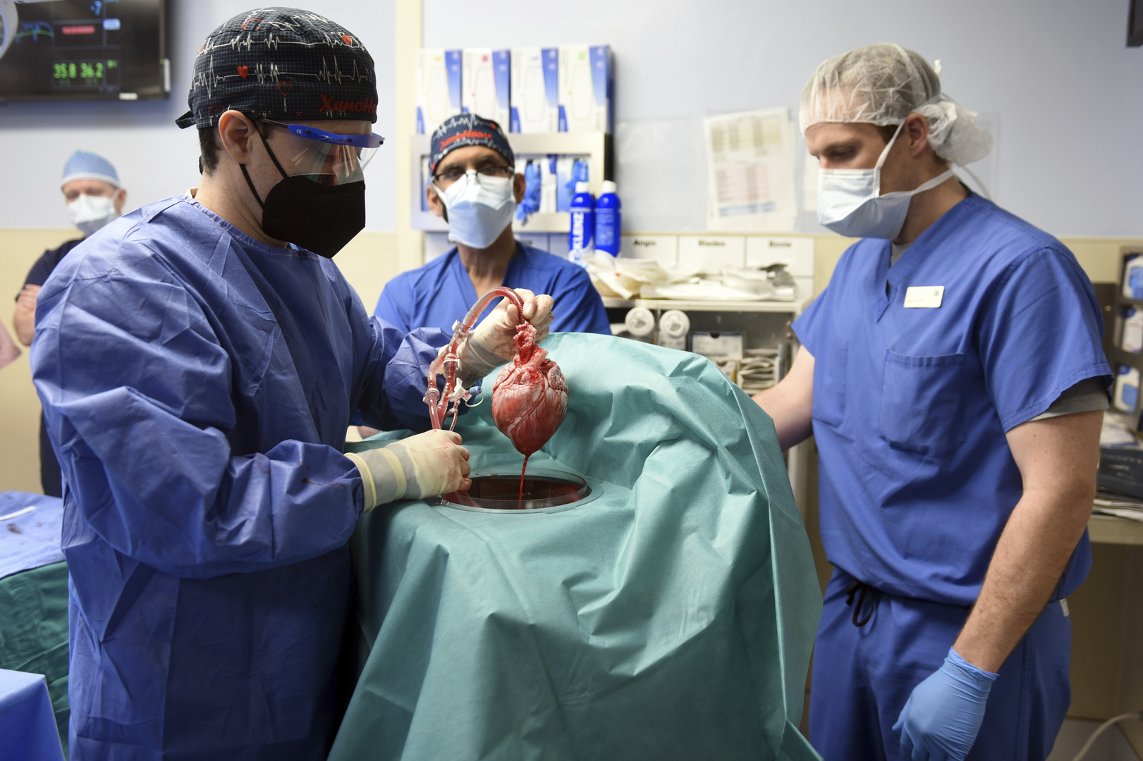 Des chirurgiens américains ont greffé avec succès le cœur d'un porc sur un humain