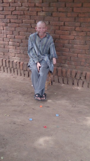 Africa albinos attacked in Tanzania