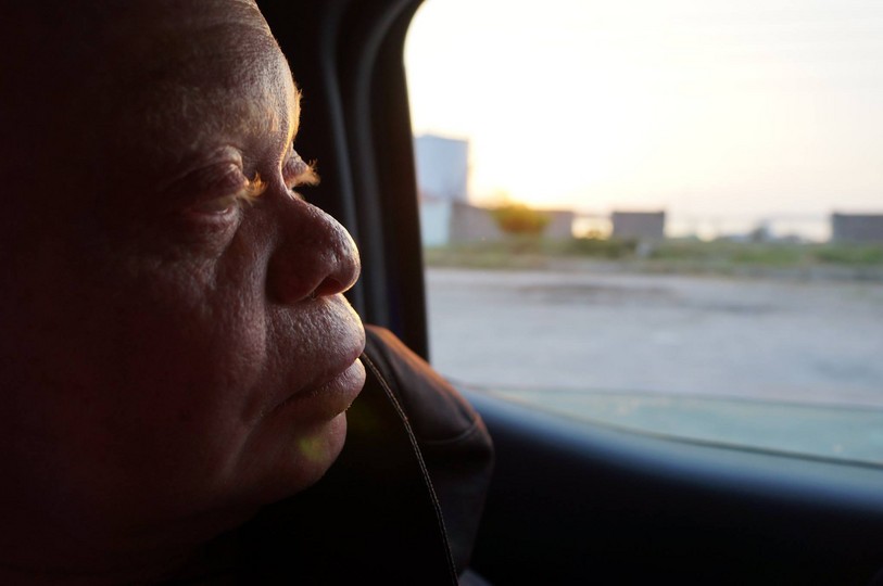 Africa albinos attacked in Tanzania