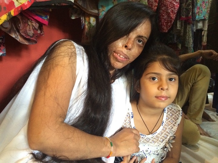 Acid attack survivors in India