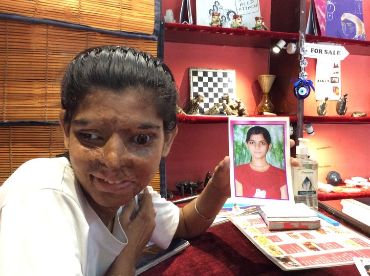 Acid attack survivors in India