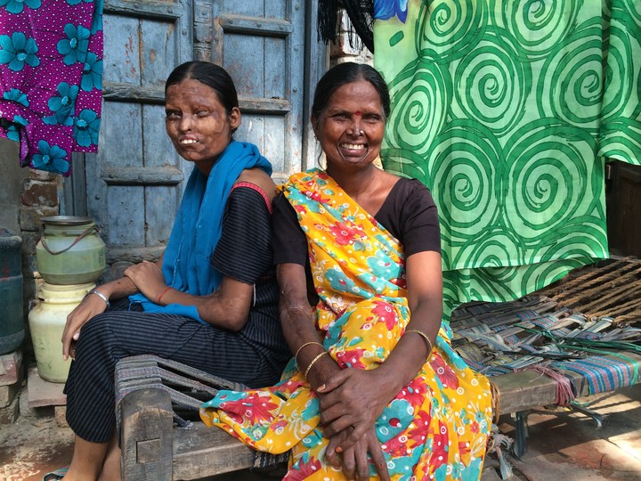Acid attack survivors in India