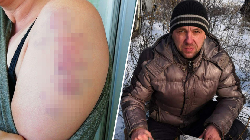 «Угрожал убийством»: мать двоих детей из Читы рассказала, как её избивал и запугивал бывший муж