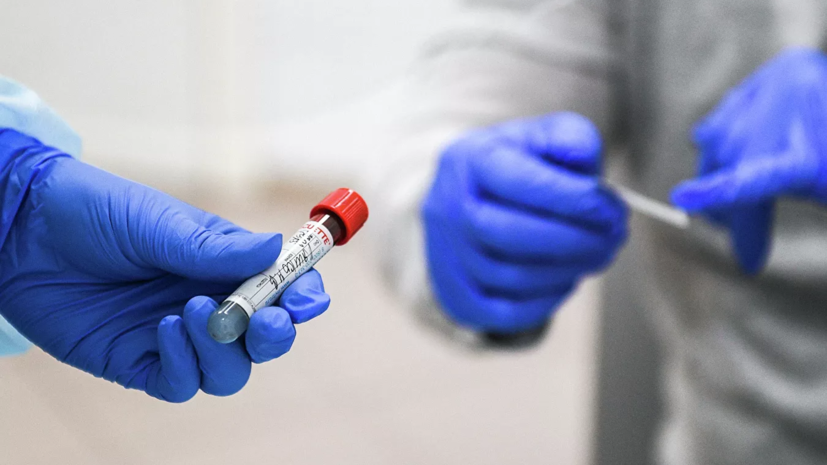 Москвичи смогут сдать ПЦР-тест на коронавирус бесплатно с 16 июля