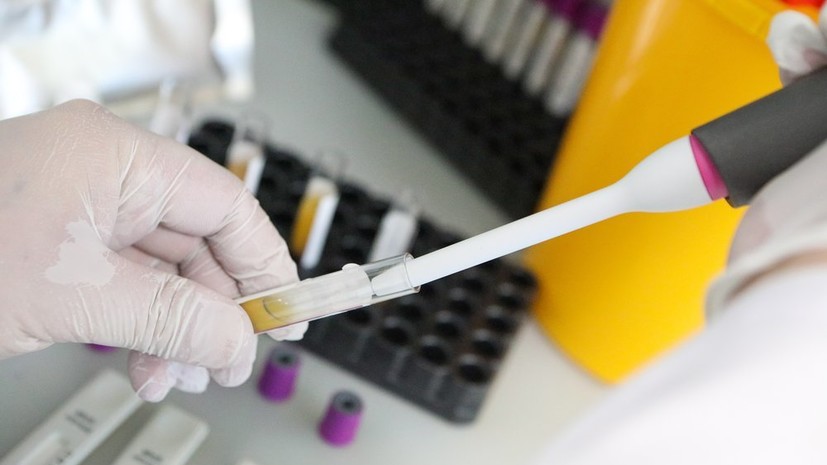 Более 34,8 млн тестов на коронавирус проведено в России