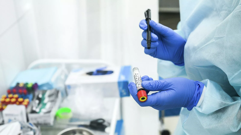 Россия разработала более 200 тест-систем для диагностики коронавируса