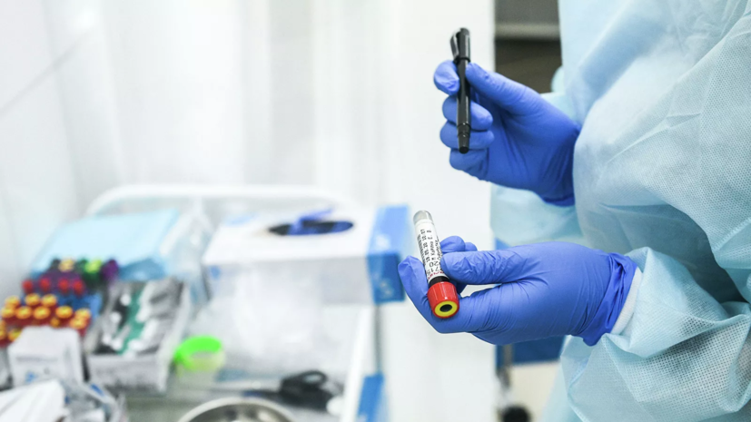 В Омской области прокомментировали ситуацию с COVID-19