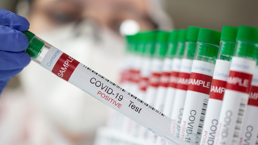 В Тверской области выявили 72 случая COVID-19 за сутки
