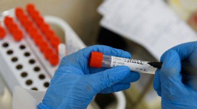 В Оренбургской области прокомментировали ситуацию с COVID-19