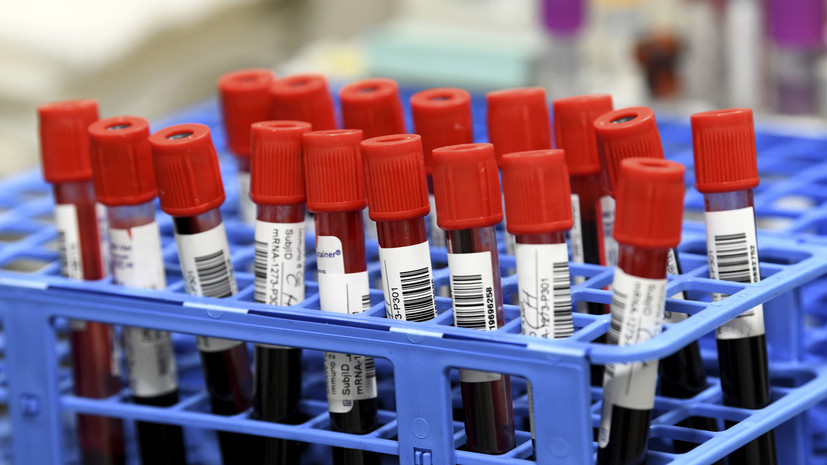 В Калужской области прокомментировали ситуацию с COVID-19