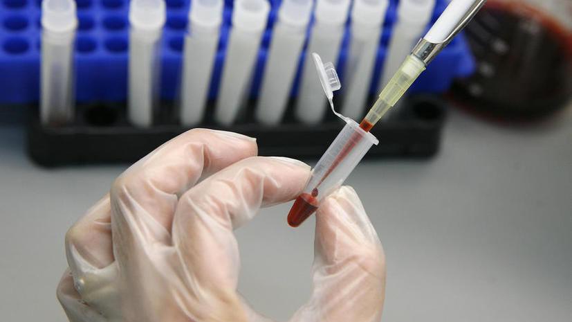 Учёные открыли новый агрессивный штамм ВИЧ